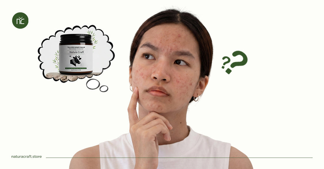 Tallow and Honey Balm for Eczema: Does it actually help